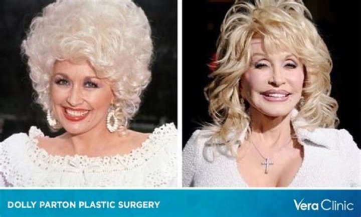 Dolly Parton and Plastic Surgery