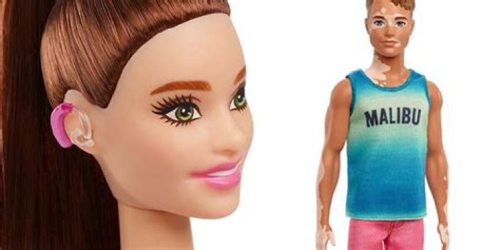 Mattel debuts Barbie with hearing aids, Ken with vitiligo